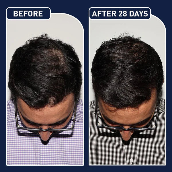 🌟 FEG Hair Growth Spray 🌟